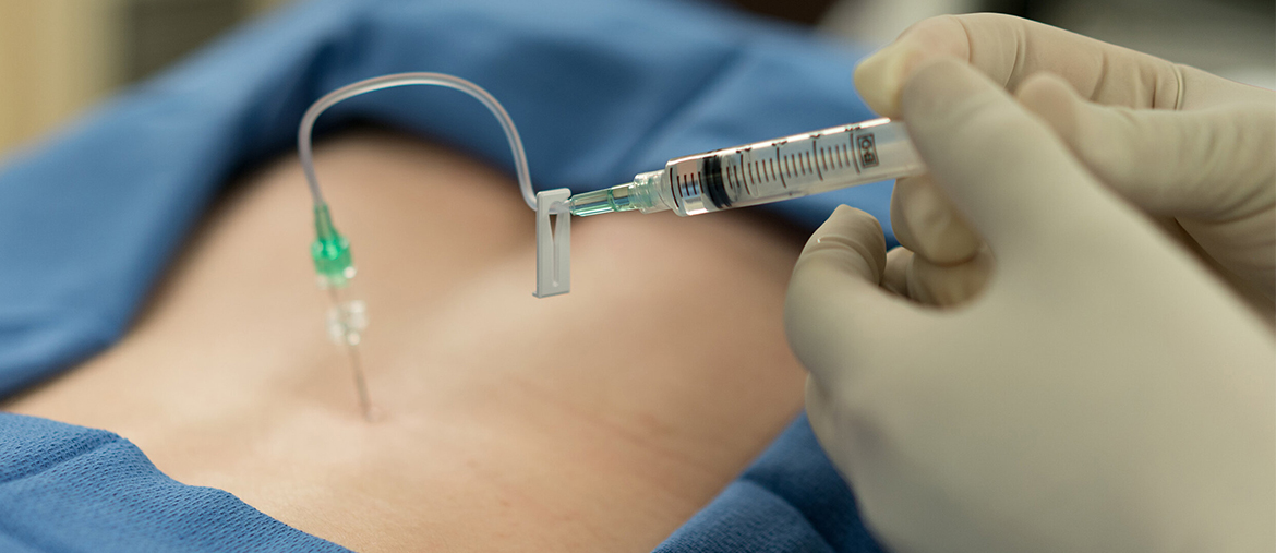 What It Is Lumbar Puncture Services in Plano TX